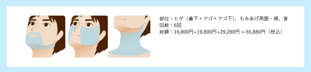 湘南美容クリニックのメンズ脱毛